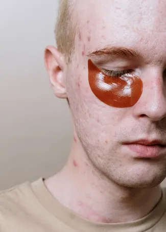 2. ¿Puedo utilizar productos de cuidado de la piel para prevenir arrugas faciales?