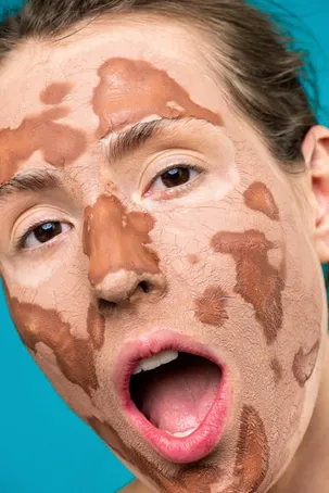 5. ¿Puedo usar la mascarilla de aloe vera si tengo la piel seca?