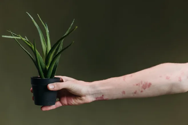 Beneficios del aloe vera para la piel