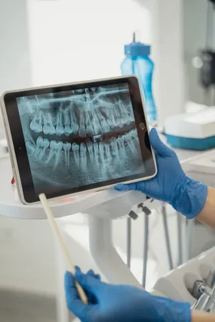 Beneficios para la salud dental